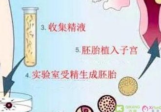 在深圳做试管用长方案短方案哪个贵？