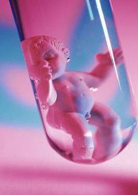 试管婴儿移植前是做腹扎效果好还是环扎好