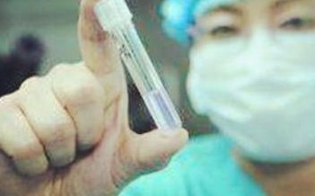 准备做试管婴儿前应该吃什么