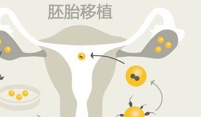 北京高龄三代试管婴儿哪个医院好？放心选择这些医院